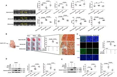 Ubc9 Attenuates Myocardial Ischemic Injury Through Accelerating Autophagic Flux